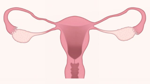 L’endometriosi: anche malattia sociale